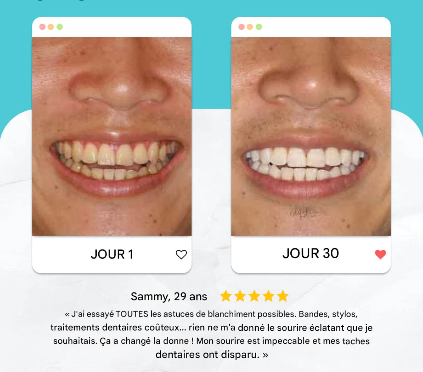 Brosse Propulsmile™️