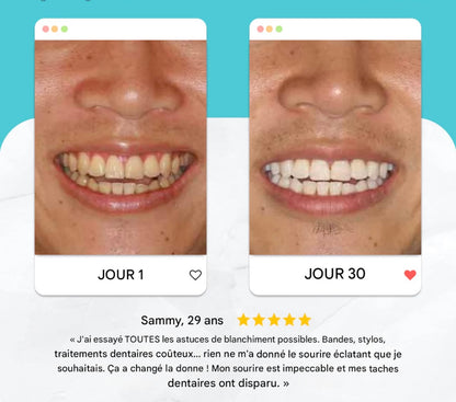 Brosse Propulsmile™️